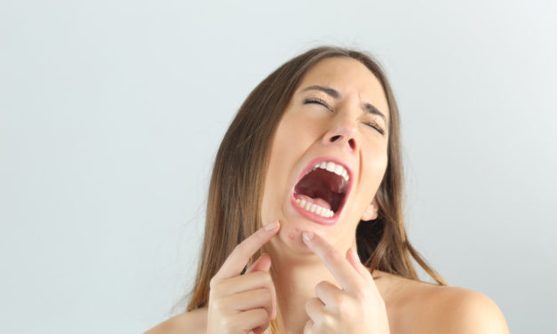 This is what’s giving you acne