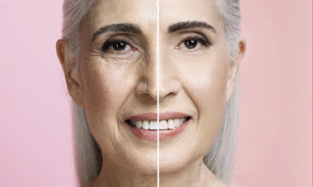 How to Decide if Plastic Surgery is Right for You? 